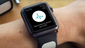 Kann die nächste Apple Watch ein EKG erstellen?