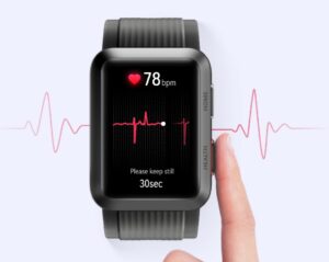 EKG-Messung per Smartwatch: Längst keine Revolution mehr, aber was taugt sie?